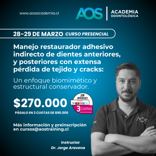 28-29 de marzo 2025 | Curso presencial | Manejo restaurador adhesivo indirecto de dientes anteriores, y posteriores con extensa pérdida de tejido y cracks: Un enfoque biomimético y estructural conservador.