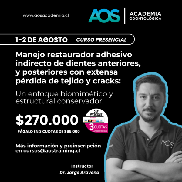 1-2 de agosto 2025 | Curso presencial | Manejo restaurador adhesivo indirecto de dientes anteriores, y posteriores con extensa pérdida de tejido y cracks: Un enfoque biomimético y estructural conservador.