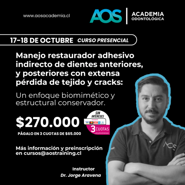 17-18 de octubre 2025. | Curso presencial | Manejo restaurador adhesivo indirecto de dientes anteriores, y posteriores con extensa pérdida de tejido y cracks: Un enfoque biomimético y estructural conservador.