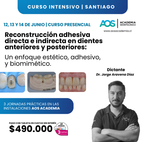 12, 13, 14 de Junio 2025. Restauración adhesiva directa e indirecta en dientes anteriores y posteriores: Un enfoque estético, adhesivo, y biomimético.
