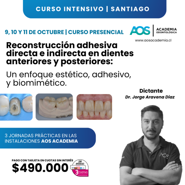 9, 10 y 11 de Octubre 2025. Restauración adhesiva directa e indirecta en dientes anteriores y posteriores: Un enfoque estético, adhesivo, y biomimético.