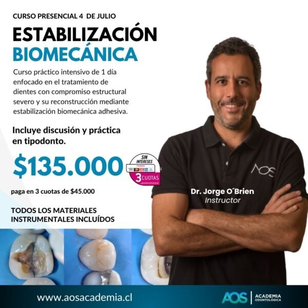 Curso presencial | Estabilización Biomecánica del diente posterior. 4 de Julio