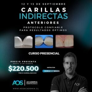 12-13 Septiembre Curso presencial | Carillas Indirectas anteriores: Protocolo confiable para resultados óptimos