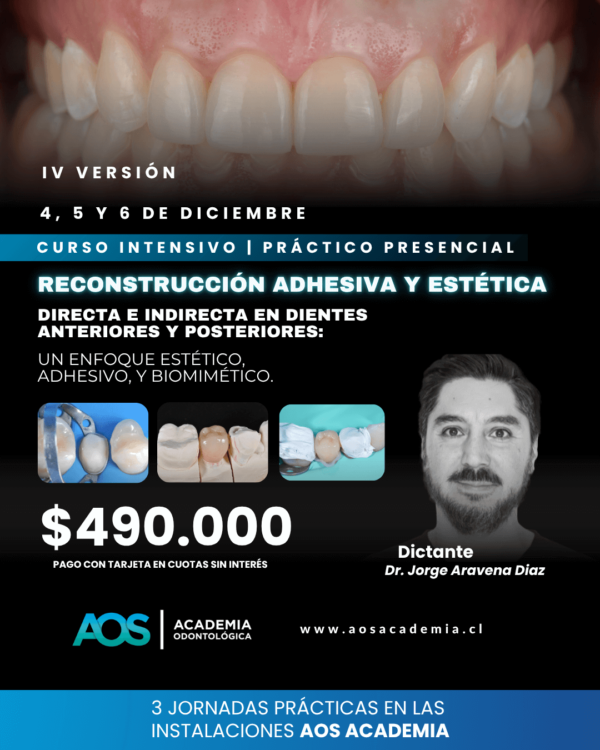 4, 5 Y 6 de Diciembre 2025. Restauración adhesiva directa e indirecta en dientes anteriores y posteriores: Un enfoque estético, adhesivo, y biomimético. IV versión