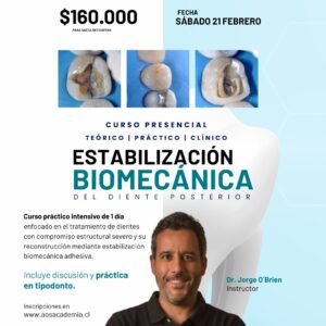 Curso presencial | Estabilización Biomecánica del diente posterior. 21 de Febrero