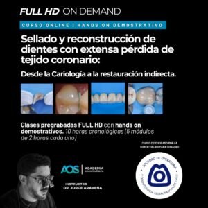 Curso online con hands on demostrativos "Sellado y reconstrucción de dientes con extensa pérdida de tejido coronario: Desde la Cariología a la restauración indirecta".