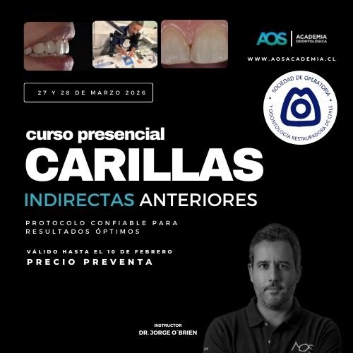 27 y 28 de Marzo 2026 Curso presencial | Carillas Indirectas anteriores: Protocolo confiable para resultados óptimos (copia)