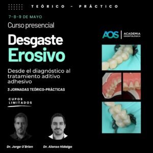 7,8, 9 de mayo. Curso presencial | Desgaste  Erosivo: Desde el diagnóstico al tratamiento aditivo adhesivo