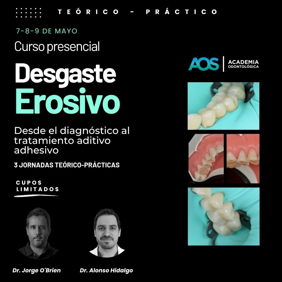 7,8, 9 de mayo. Curso presencial | Desgaste Erosivo: Desde el diagnóstico al tratamiento aditivo adhesivo
