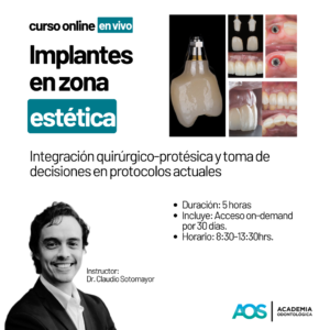 Curso Online: Implantes en zona estética. Integración quirúrgico-protésica y toma de decisiones en protocolos actuales