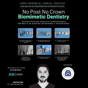 Reconstrucción adhesiva indirecta en dientes anteriores y posteriores con extensa pérdida de tejido: build ups, preparaciones horizontales y verticales, flujo digital, flujo laboratorial, conexión adhesiva