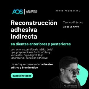Reconstrucción adhesiva indirecta en dientes anteriores y posteriores con extensa pérdida de tejido: build ups, preparaciones horizontales y verticales, flujo digital, flujo laboratorial, conexión adhesiva