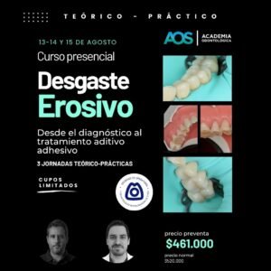 13-14 y 15 de agosto. Curso presencial | Desgaste  Erosivo: Desde el diagnóstico al tratamiento aditivo adhesivo