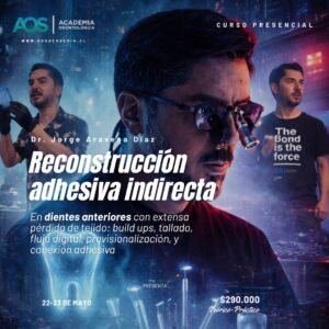 Reconstrucción adhesiva indirecta en dientes anteriores con extensa pérdida de tejido: build ups, tallado, flujo digital, provisionalización, y conexión adhesiva