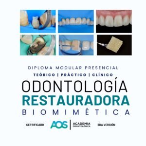 Diploma modular teórico-práctico-clínico en Odontología Restauradora Adhesiva estructural y Biomimética. Segunda Versión