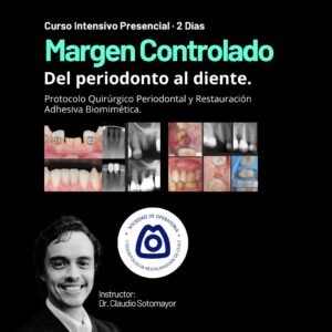 Margen Controlado | Del Periodonto al Diente — Protocolo Quirúrgico Periodontal y Restauración Adhesiva Biomimética