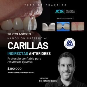 28 y 29 de Agosto. Curso presencial | Carillas Indirectas anteriores: Protocolo confiable para resultados óptimos