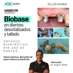 Biobase en dientes desvitalizados y tallado:enfoque biomimético sin uso de postes.