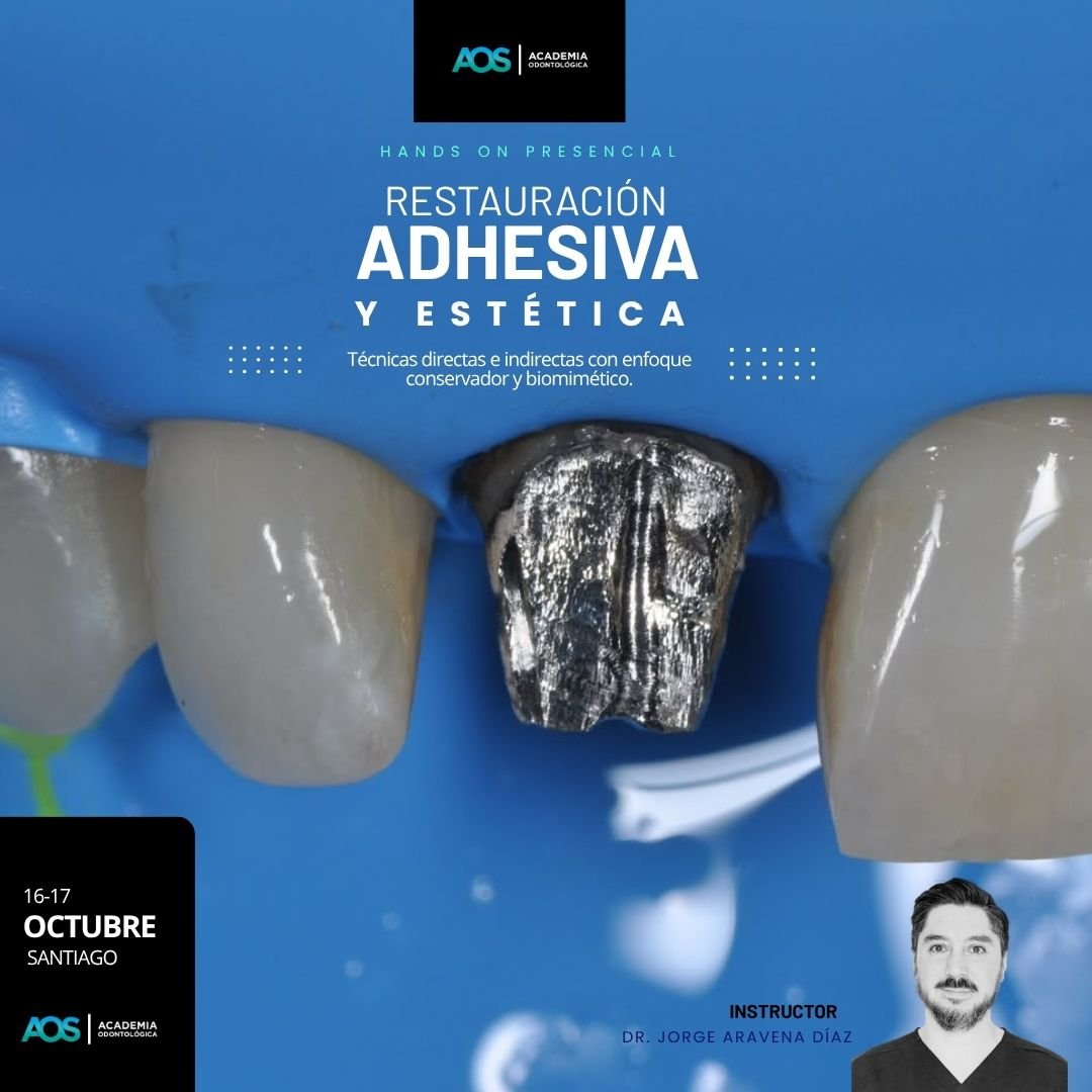16-17 de octubre. Restauración adhesiva y estética de dientes anteriores: Técnicas directas e indirectas con enfoque conservador y biomimético.