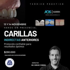 13 y 14  de Noviembre. Curso presencial | Carillas Indirectas anteriores: Protocolo confiable para resultados óptimos
